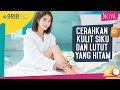 5 Bahan Alami untuk Cerahkan Kulit Siku dan Lutut Hitam