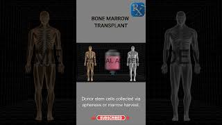 🧬 Bone Marrow Transplant (BMT) - Step-by-Step Explained in 60 Seconds! 🔬