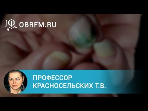 Профессор Красносельских Т.В.: Болезни ногтей