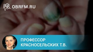 Профессор Красносельских Т.В.: Болезни ногтей