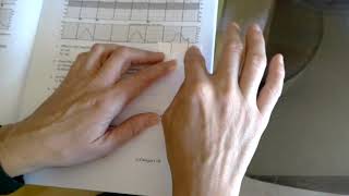 Learning to measure duration and frequency of contractions