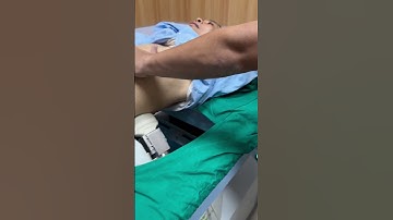 Tán sỏi ngoài cơ thể #Soithan #tansoithan  #bacsitung #pcnl #aroretic #akicare #soinieuquan