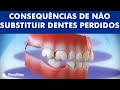 Consequências de não substituir dentes perdidos ©