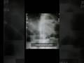 must know radiological images|@ambitiousdoc