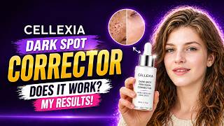 Cellexia Dark Spot Precision Corrector Review 🔥 Does It Work? Watch My Results ✨