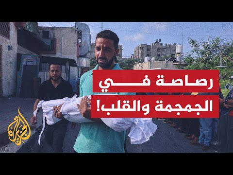 أطفال غزة بين الحرب والجوع.. شهادات أطباء عن المأساة في القطاع