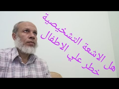 خطورة الاشعة علي الاطفال