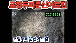 포항두피문신아트킴 정수리1차