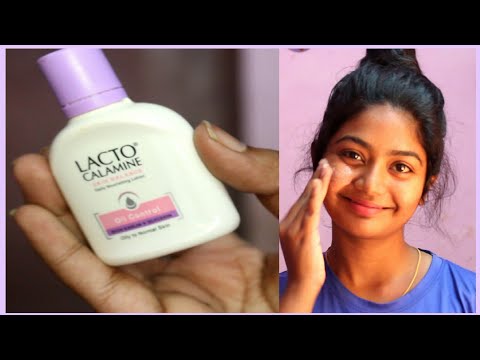 Lacto Calmine Lotion/ moisturiser Review||remove acne pimples & scar marks||SimplyMyStyle ||MALAYALI