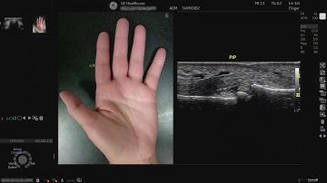 LOGIQ P9 Tutorials: Remote Control and Photo Assistant