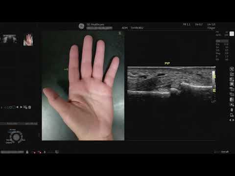 LOGIQ P9 Tutorials: