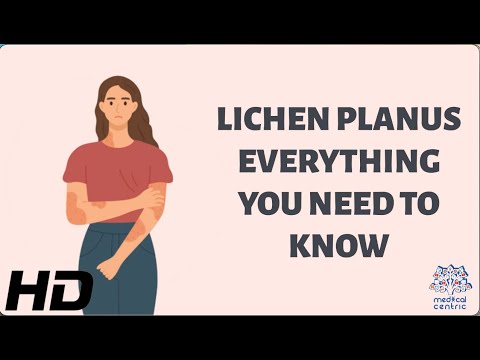 Video: Měl by být orální lichen planus biopsií?