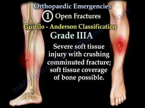 Orthopaedic Emergencies Part 3 - Everything You Need To Know - Dr. Nabil Ebraheim