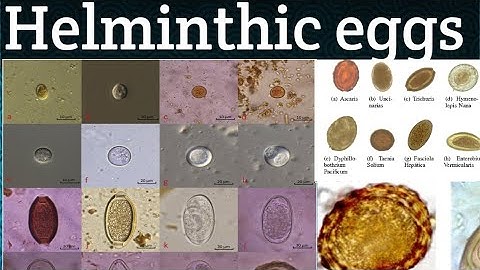 Different Parasitic/Helminthic eggs ll Vet Parasitology ll Trematodes#Cestodes#Nematodes#Vetjunction