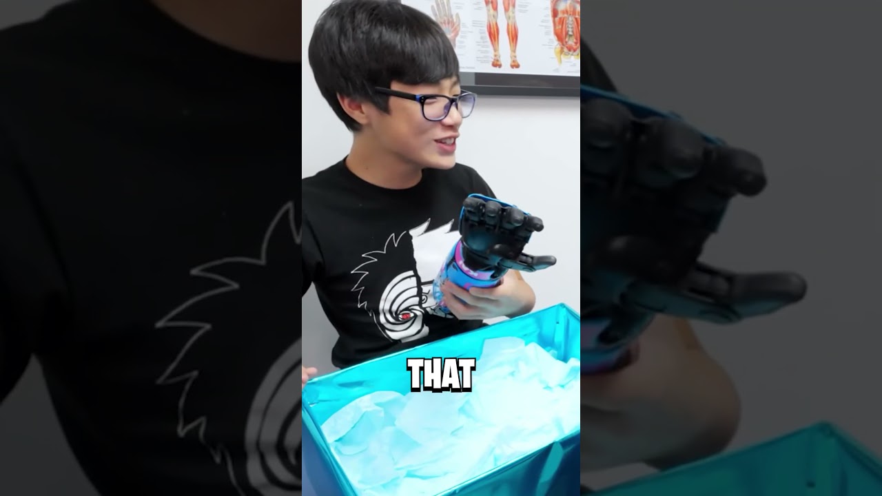 MrBeast's Bionic Arm!