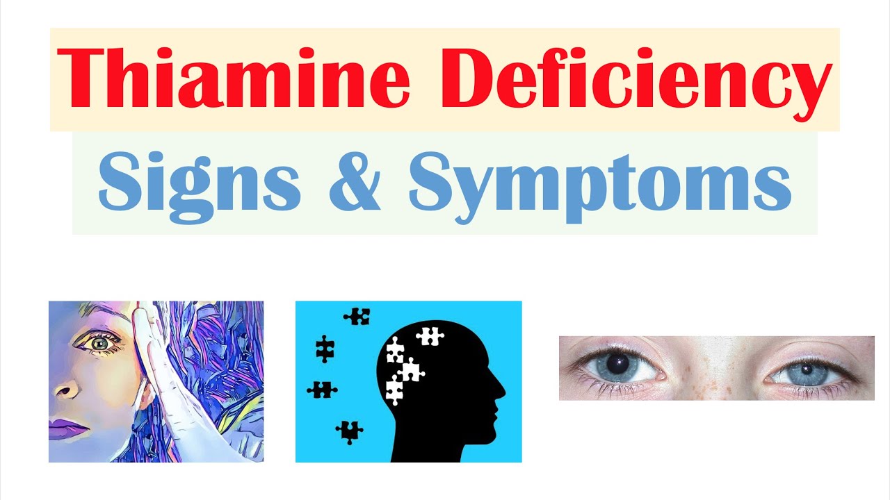 Who Is At The Greatest Risk Of Experiencing Thiamin Deficiency