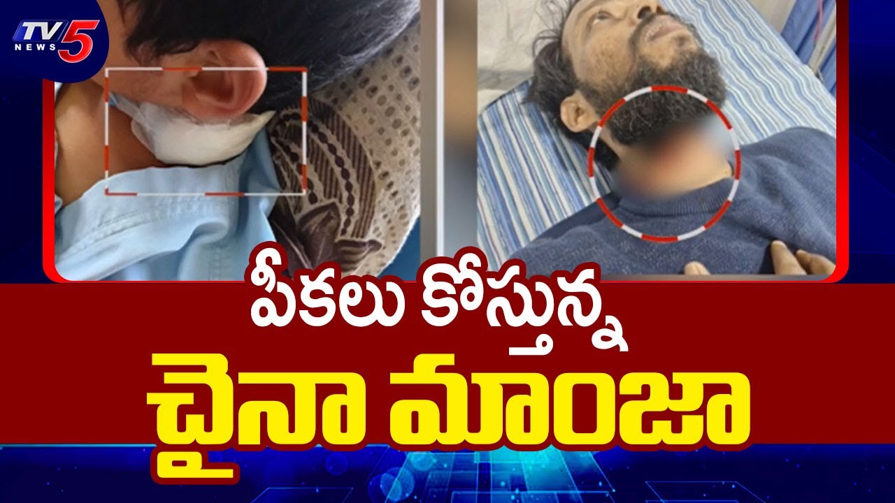 Be Careful : పీకలు కోస్తున్న చైనా మాంజా | China Manja | Sankranthi Celebrations | TV5 News