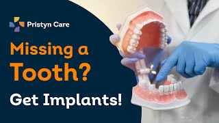 What Are Dental Implants | Benefits of Dental Implants | Best Dental Clinic