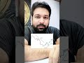 Candle stick pattern that actually works #bitcoinupdate #candlestickpatterns