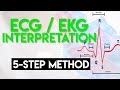 ECG Interpretation Made Easy | ECG EKG Interpretation (Part 2)