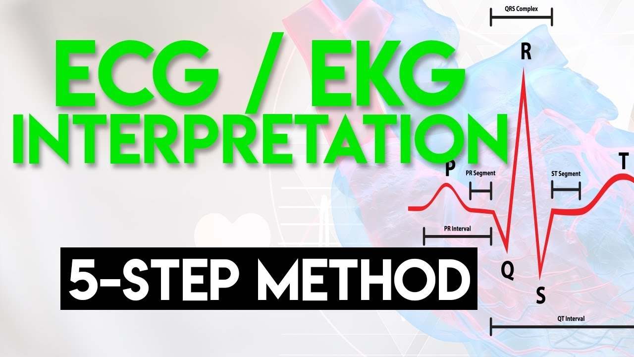 ECG Interpretation Made Easy | ECG EKG Interpretation (Part 2)