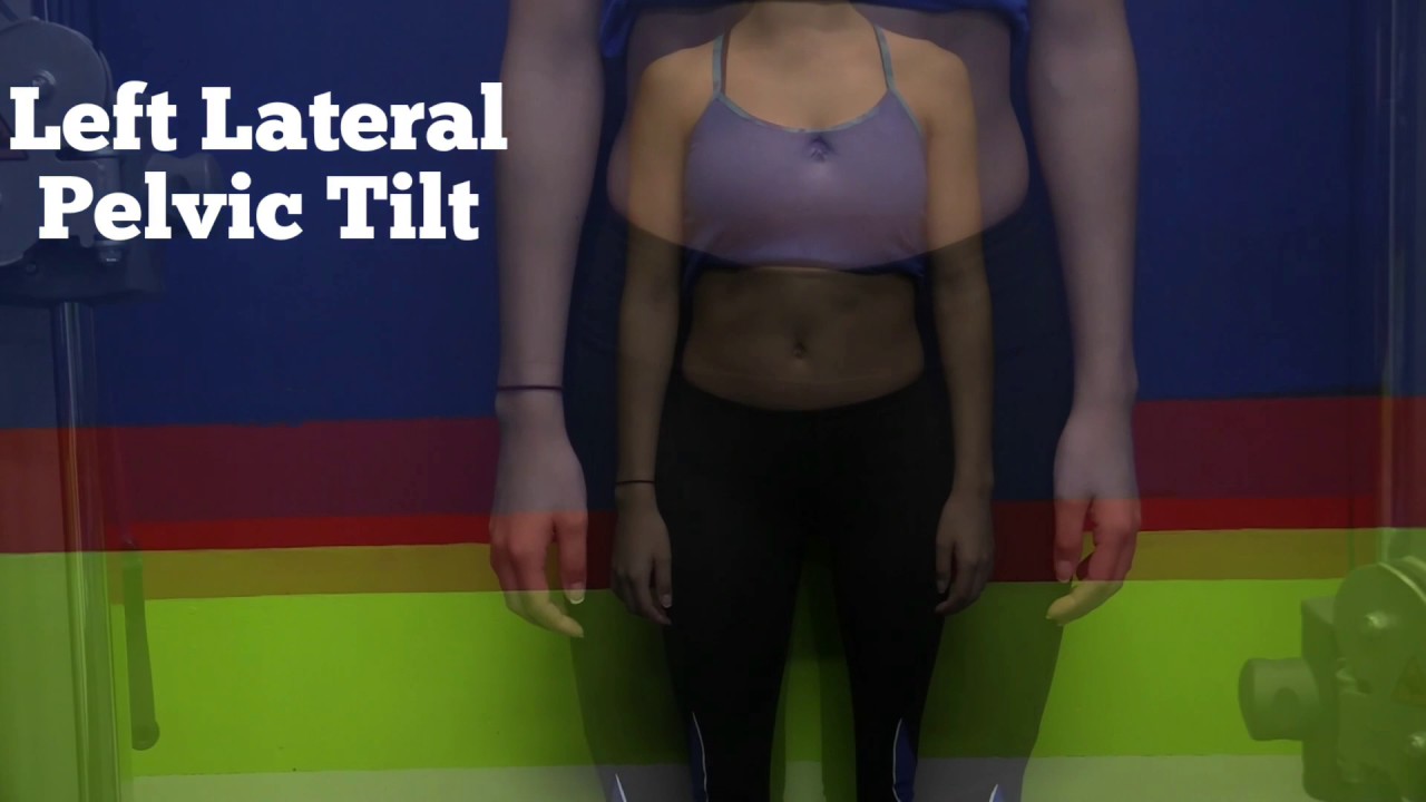 Left Tilted Left Lateral Pelvic Tilt - YouTube