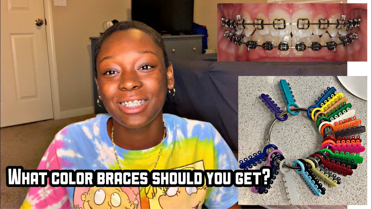 Braces Colors For Dark Skin 