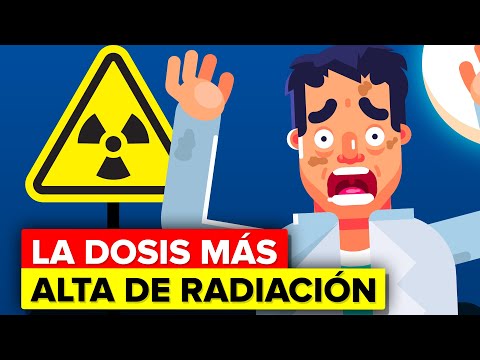 Vídeo: ¿Qué Tan Grandes Dosis De Radiación Afectan Realmente Al Cuerpo Humano? - Vista Alternativa