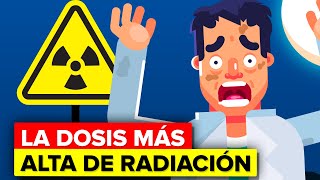 Hombre recibe la dosis más alta de radiación nuclear - Esto es lo que le pasó.