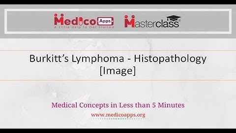 Burkitt’s Lymphoma - Histopathology (Image)