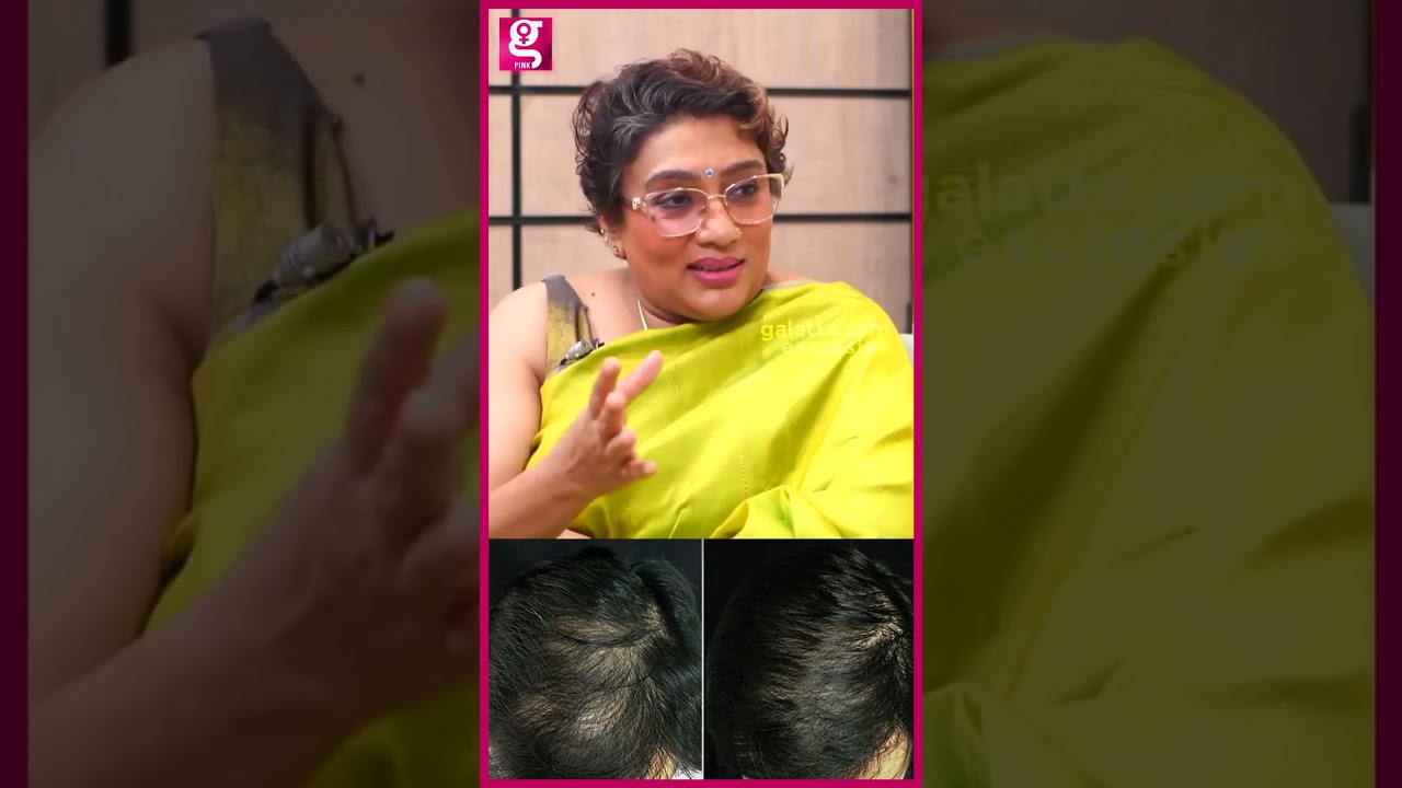 Baldness க்கு 