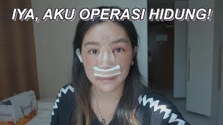 AKU PUNYA HIDUNG BARU!