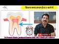 कितनी ROOTS /CANALS होती है कितना aur कितना समय लगता है RCT करने मेंअलग अलग दांतो में