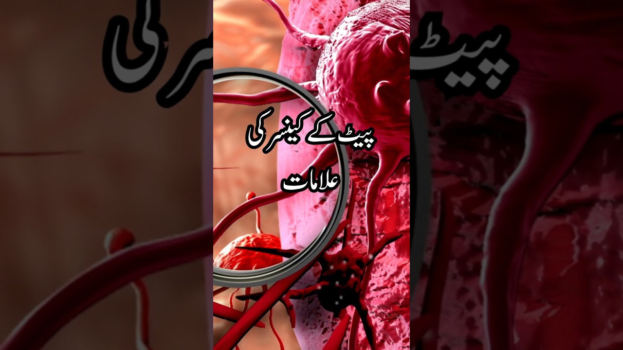Stomach Cancer Symptoms in Urdu | Stomach Cancer ki alamat in urdu