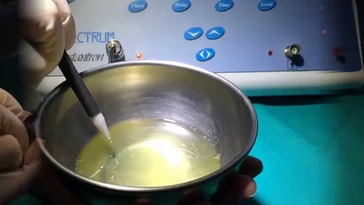 THE EGG WHITE TEST YouTube