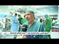 بدء عملية فصل التوأم الملتصق التنزاني