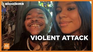 Phoenix man says he was stabbed multiple times in violent attack