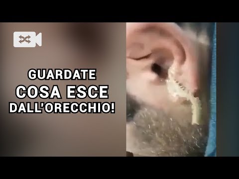 Video: Uno scarafaggio può entrare nell'orecchio o nel naso di una persona?