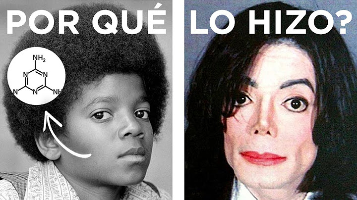 Cómo logró Michael Jackson cambiar su piel?