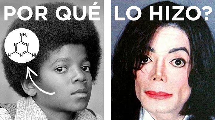 Cmo logr Michael Jackson cambiar su piel?