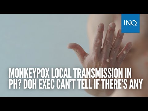 Monkeypox local transmission in PH? DOH exec can’t tell if there’s any