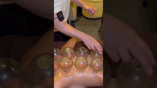 ASMR: STRONG CHINESE Back Shoulder Neck Massage with Cupping shorts