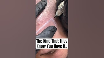 Most Realistic Scalp Micro Pigmentation