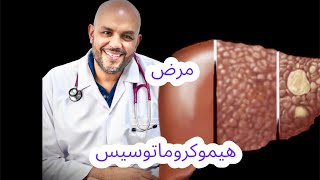 مرض الكبد هيموكروماتوسيس / Haemochromatosis