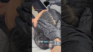 Korean Scalp Shading | Scalp Painting for Thinning Hair | No Shave SMP #ScalpShading #Shorts #learn
