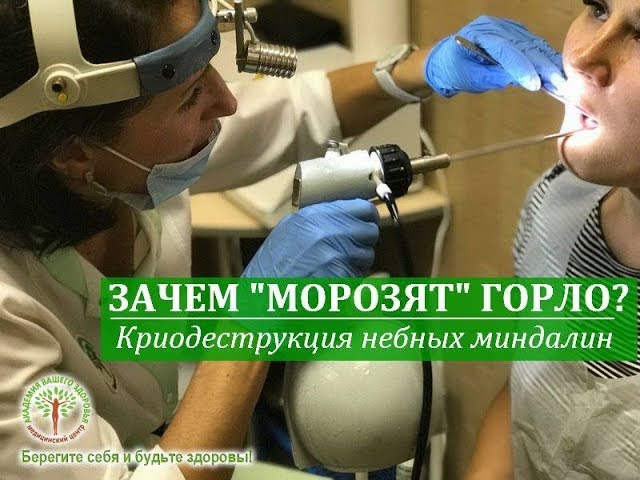 Криодеструкция (криолечение) миндалин в Киеве
