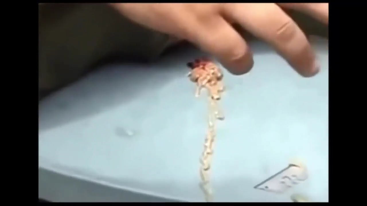 blackhead popping 2021