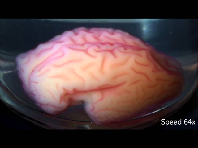 New research replicates a folding human brain in 3D 
