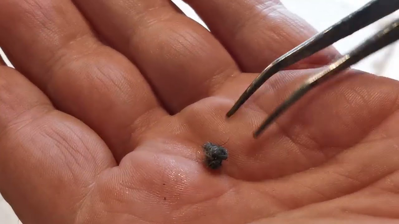 What causes this filter blockage?