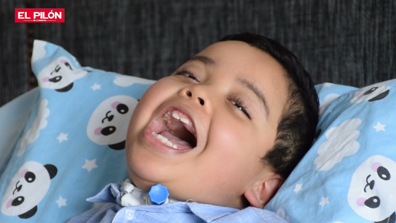 Así es vivir con Guillain Barré